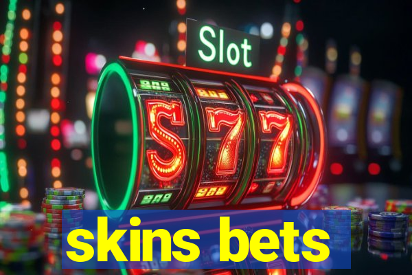 skins bets