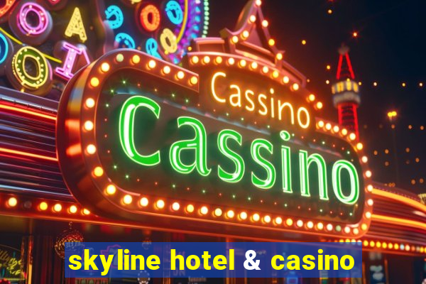 skyline hotel & casino